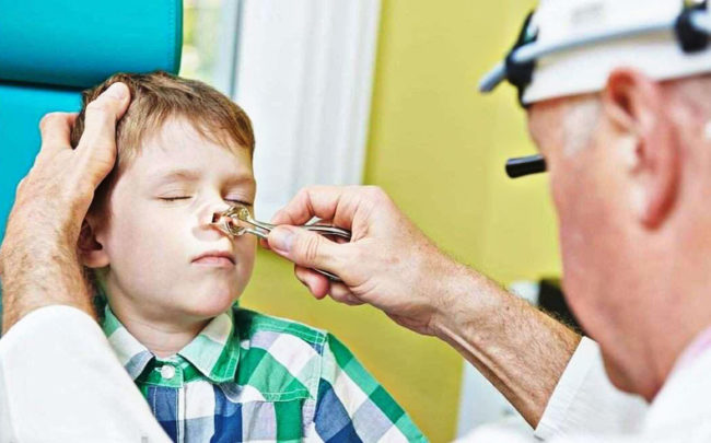 Ребёнок на осмотре у врача ЛОРа осмотр носа
