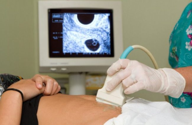 Процедура узи у беременной женщины на начальном сроке