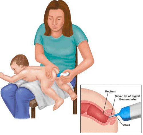 Положение ребёнка при ректальном измерении температуры
