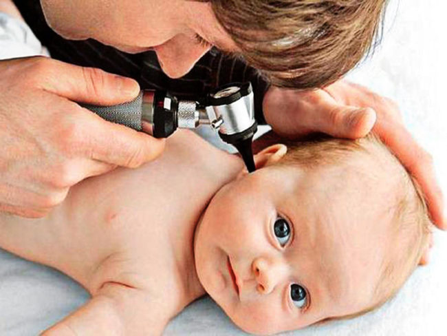 Осмотр уха у новорождённого ребёнка при подозрении на средний отит ЛОР-врачом