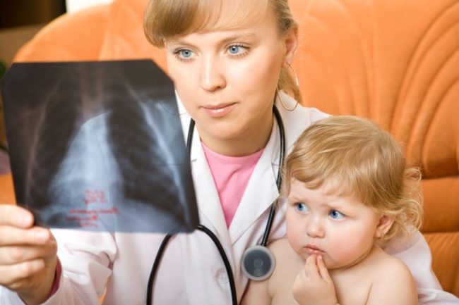 Врач с ребёнком на руках осматривает фото с рентгеновским снимком лёгких