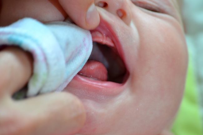 Гигиеническая обработка рта у грудного ребёнка
